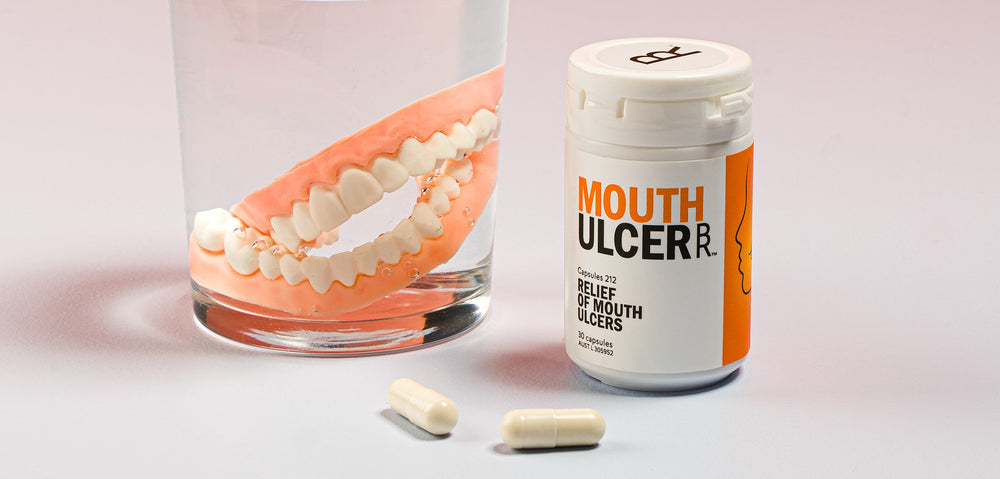MouthUlcer