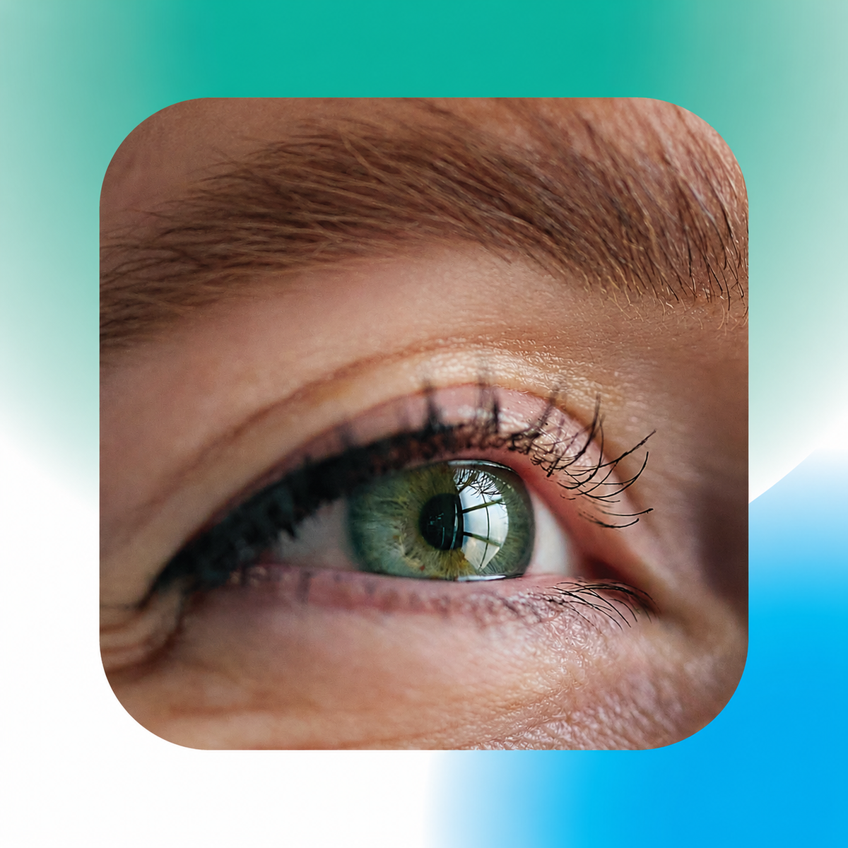 Eyes