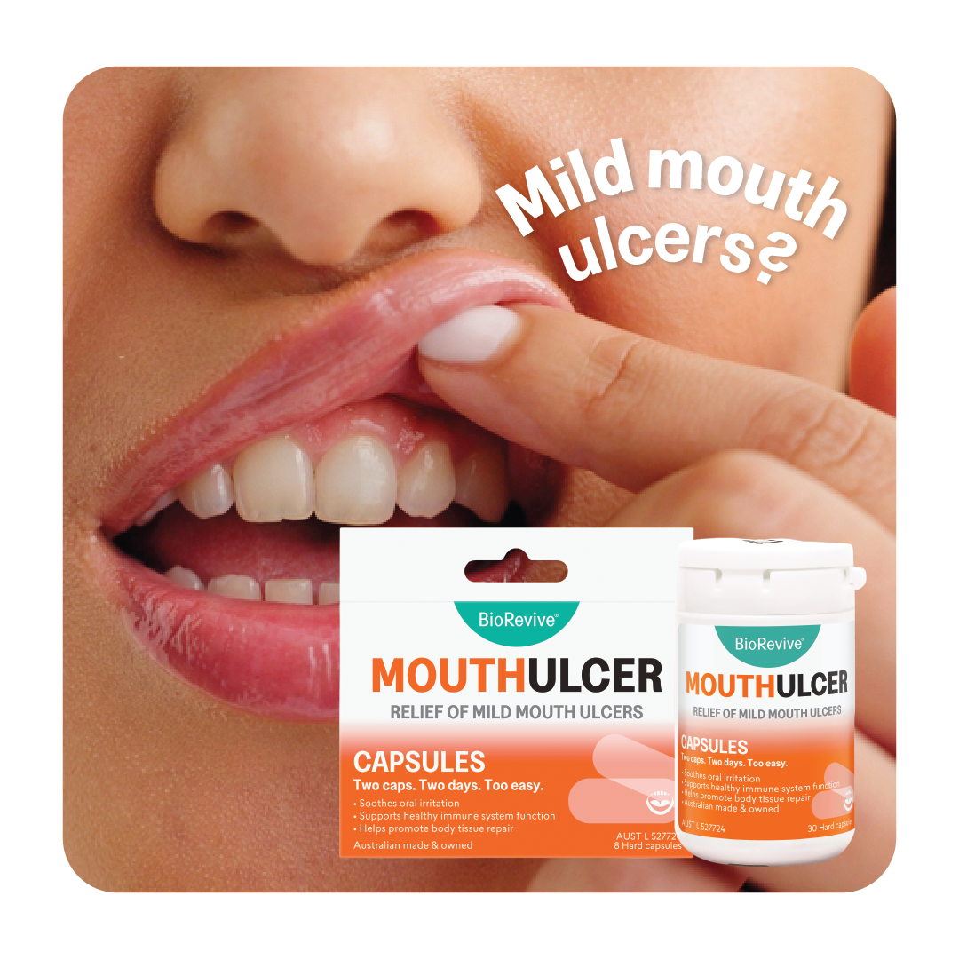 MouthUlcer – Mouth Ulcer Relief 30 Capsules