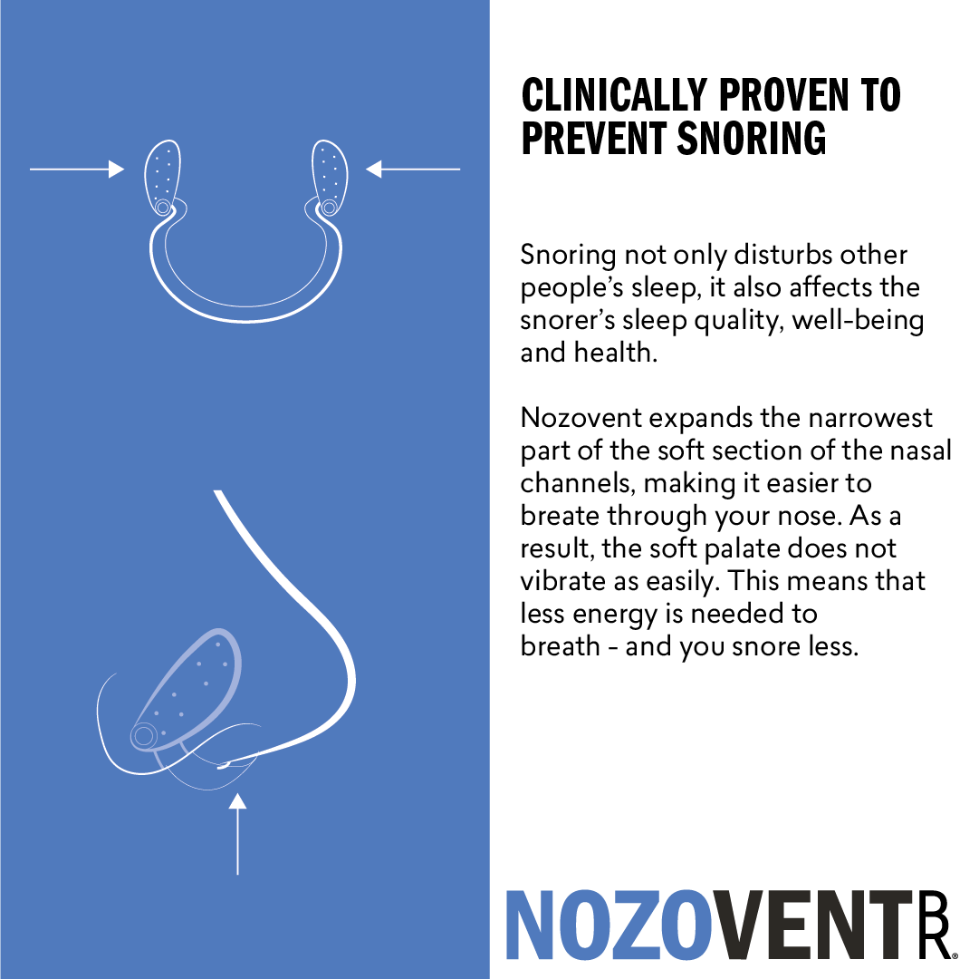 How NozoVent snoring prevention device works - BioRevive